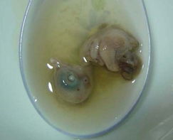 全球最震撼的诡异食物 鸡胎蛋的禁忌与微妙风味